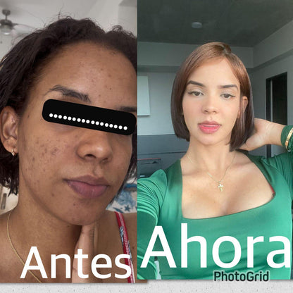 Crema Anti-Manchas 345