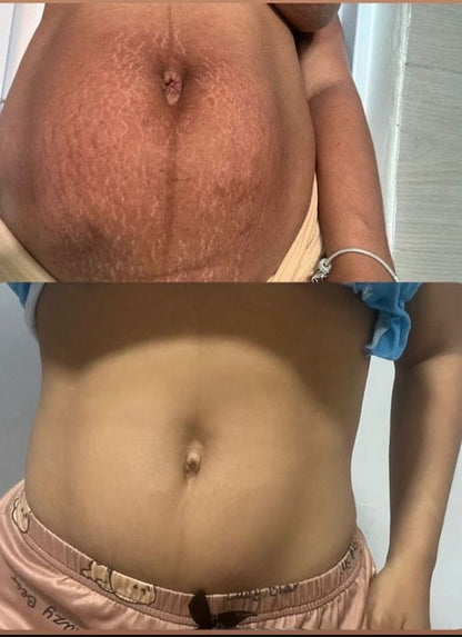 YIYU Original 100 Pads –  para una Piel Más limpia y Radiante