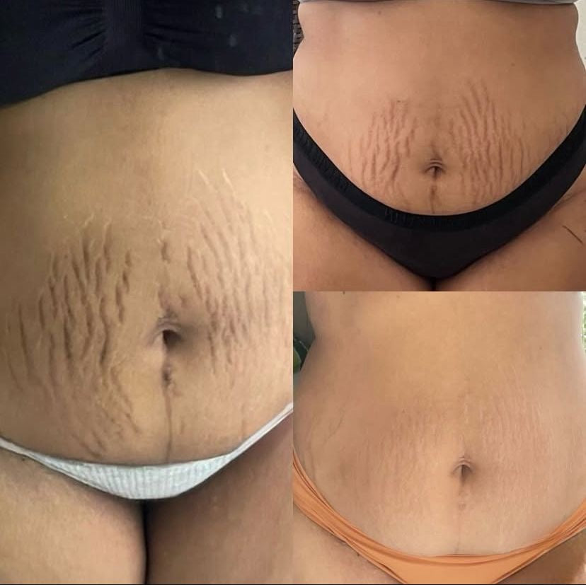YIYU Original 100 Pads –  para una Piel Más limpia y Radiante