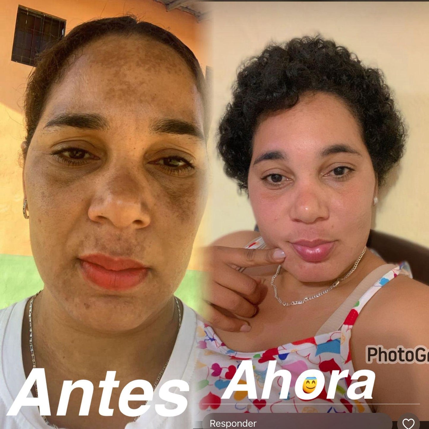 Crema Anti-Manchas 345