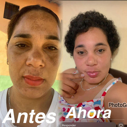 Crema Anti-Manchas 345