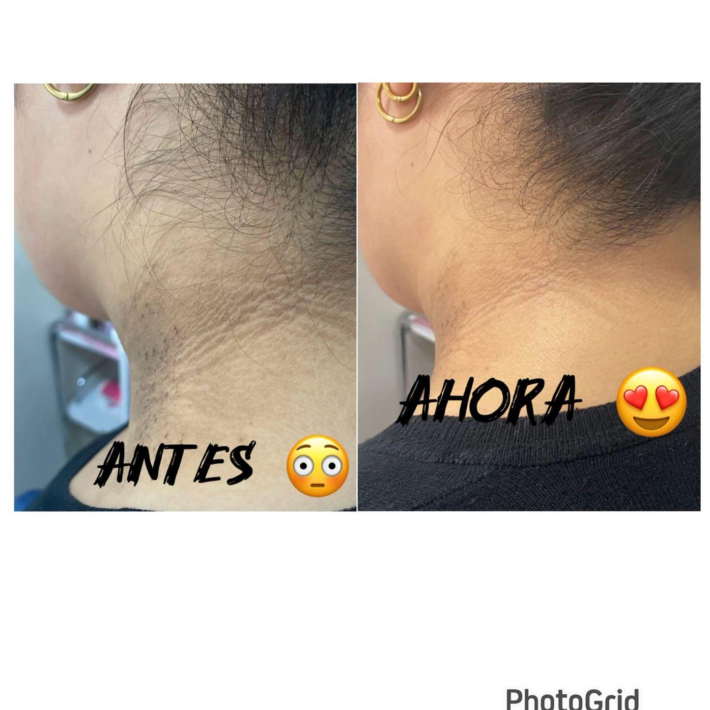 Crema Anti-Manchas 345