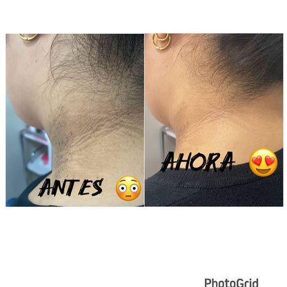 Crema Anti-Manchas 345